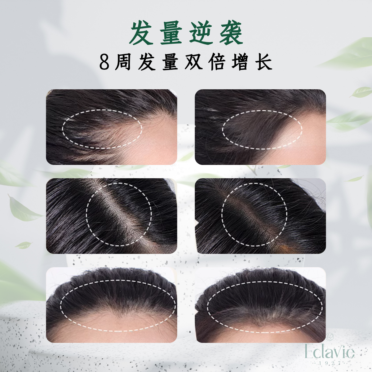 Hair Growth Booster Tonic 100ML x1